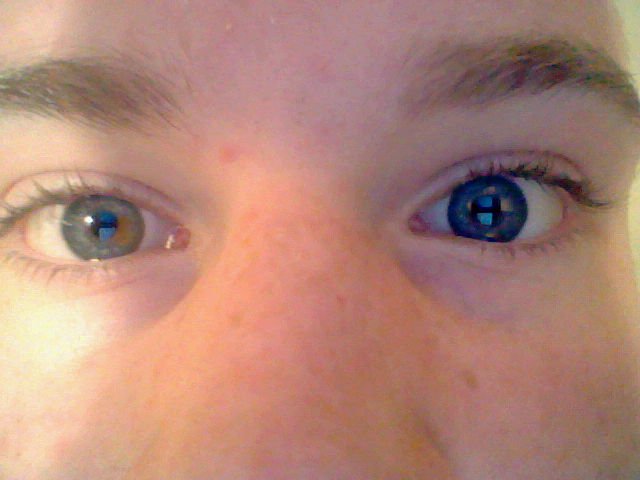 MyFreakyEyes